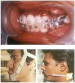 Orthodontics